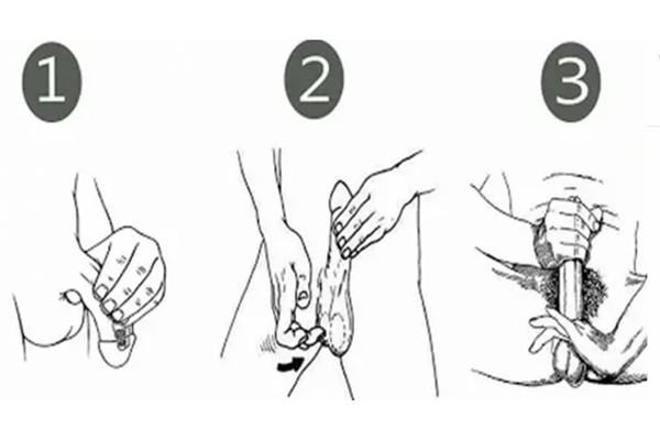 penis exercises straightening straighten curvature somewhat instances satisfying