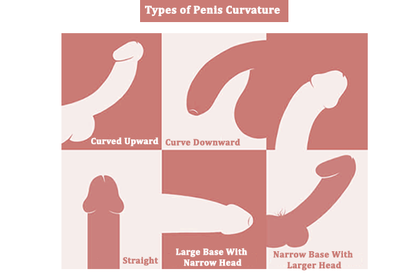 Types Of Penis Curvature