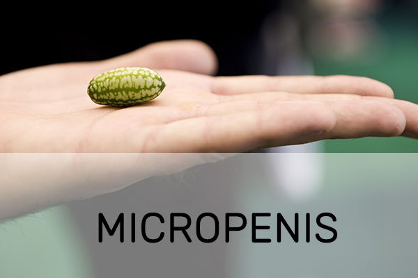 Micropenis